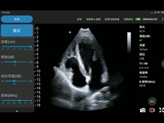 Đầu dò siêu âm không dây di động 3,6 MHz Đầu dò mảng theo pha