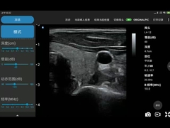 256 dòng quét Đầu dò siêu âm Ipad Đầu dò siêu âm không dây cho PICC