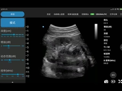 Máy quét siêu âm Wifi di động 3,6 MHz được đánh dấu CE JPEG BMP PNG MPEG-4