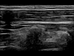 Máy siêu âm Doppler di động từ xa WiFi 12,6cm 30 khung hình / giây