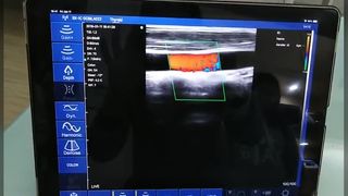 Đầu dò siêu âm không dây 128 đầu kép