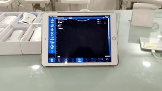Đầu dò siêu âm không dây hai đầu để chẩn đoán OB GYN