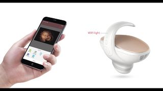 Camera thai nhi Marvoto M1- Siêu âm cầm tay 3D