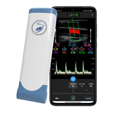Mua Máy quét siêu âm cầm tay không dây 12 MHz cho iPhone và iPad | Đầu dò Doppler màu mảng tuyến tính điện tử online manufacture