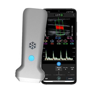 Mua Máy quét siêu âm Doppler màu cầm tay tuyến tính không dây WiFi | Hình ảnh thời gian thực 30 FPS | Đầu dò siêu âm y tế cầm tay online manufacture