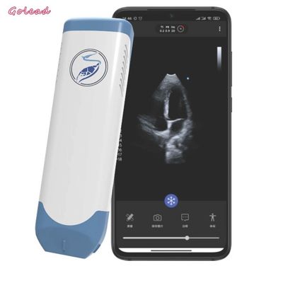 Mua Đầu dò siêu âm không dây di động 3,6 MHz Đầu dò mảng theo pha online manufacture