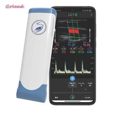 Mua Máy quét siêu âm cầm tay không dây Wifi mảng tuyến tính điện tử 12 MHz online manufacture