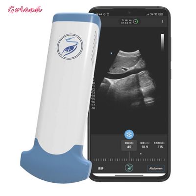 Mua Thiết bị siêu âm không dây mảng lồi điện tử cho điện thoại di động online manufacture