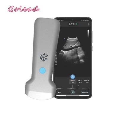 Mua Siêu âm thăm dò tim điện tử được CE phê duyệt USG dành cho Android online manufacture