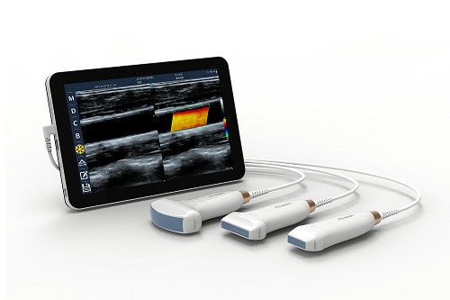 Mua Máy quét siêu âm cầm tay tuyến tính USB Type-C Đầu dò siêu âm Android di động 10 MHz cho mạch máu và POCUS online manufacture