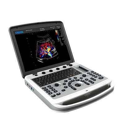 Mua Máy siêu âm xách tay Chison SonoBook 6 có thể xoay 120° online manufacture
