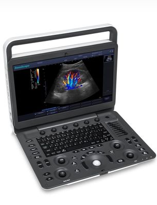 Mua Máy siêu âm LED Sonoscape E1 Exp 15,6 inch Siêu âm BW online manufacture
