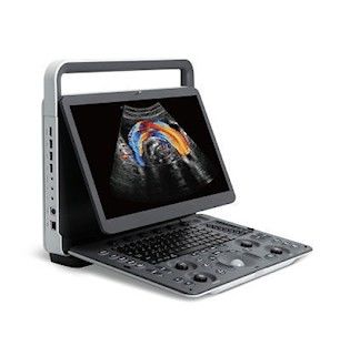 Mua Máy siêu âm cầm tay hình ảnh toàn cảnh SonoScape E2 PRO online manufacture