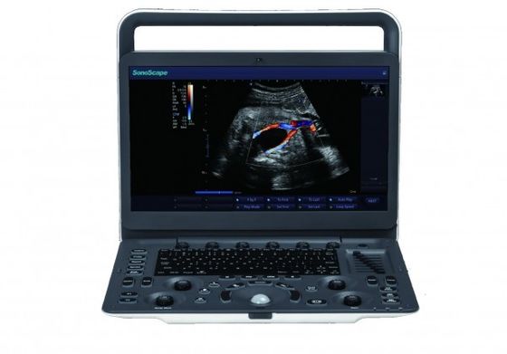 Mua 7 Cấp độ hình ảnh Máy siêu âm cầm tay SonoScape E3 với màn hình 15,6 inch online manufacture
