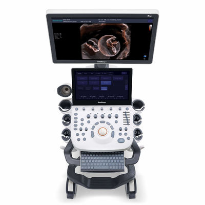 Mua Máy siêu âm 4D Elastography SonoScape dành cho sản phụ khoa online manufacture