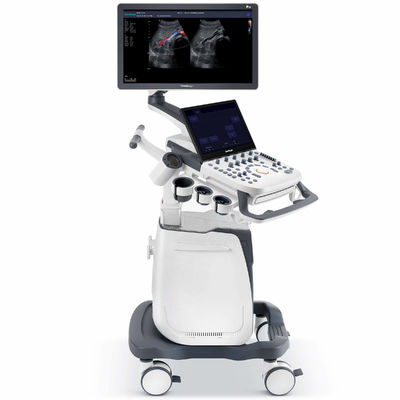 Mua Máy siêu âm hình ảnh hợp chất không gian 500GB SonoScape P25 online manufacture