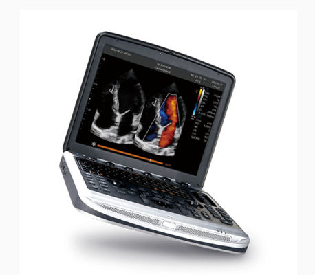 Mua Máy siêu âm máy tính xách tay được FDA chấp thuận Chison SonoBook 8 cho siêu âm tim online manufacture