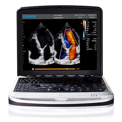 Mua Dễ Mang Theo Máy Siêu Âm Máy Tính Xách Tay 4D Chison SonoBook 9 online manufacture