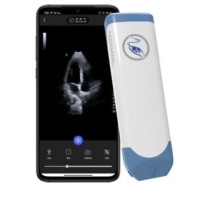 Mua Máy quét siêu âm cầm tay độ sâu 18,9cm cho iPhone 3.6 MHz online manufacture