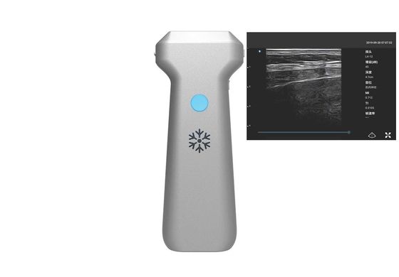 Mua Máy siêu âm cầm tay không dây thăm dò tuyến tính 32 kênh online manufacture