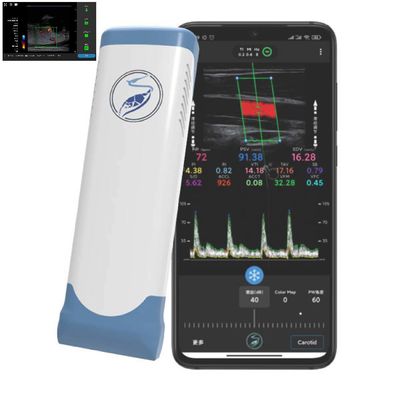 Mua 256 dòng quét Đầu dò siêu âm Ipad Đầu dò siêu âm không dây cho PICC online manufacture