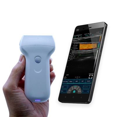 Mua Đầu dò siêu âm cầm tay không dây 96 Element được CE phê duyệt để chẩn đoán lâm sàng tại bệnh viện online manufacture