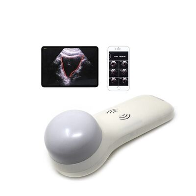 Mua Máy quét bàng quang cầm tay không dây 4D để đo thể tích nước tiểu tại điểm chăm sóc online manufacture