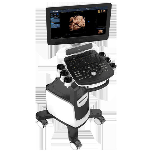 Máy siêu âm Doppler màu LED 19 inch Chison QBit 7