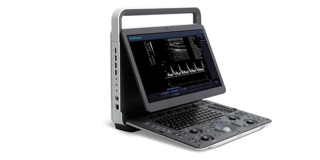 Máy siêu âm Doppler màu cầm tay LED SonoScape 15,6 inch Siêu âm BW
