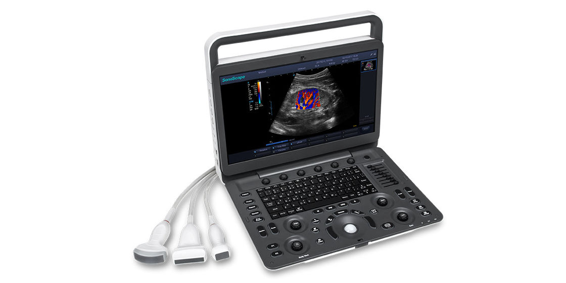 7 Cấp độ hình ảnh Máy siêu âm cầm tay SonoScape E3 với màn hình 15,6 inch