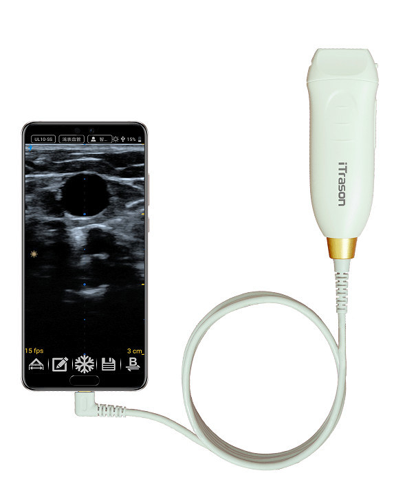 64 Kênh 20mm Depth Handheld Ultrasound Scanner để đánh giá mạch ngoại biên và tiếp cận mạch dẫn đường siêu âm