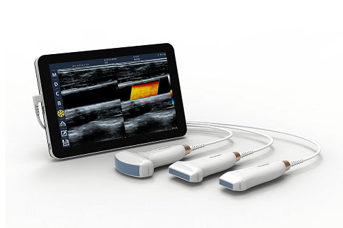 Máy quét siêu âm cầm tay tuyến tính USB Type-C Đầu dò siêu âm Android di động 10 MHz cho mạch máu và POCUS