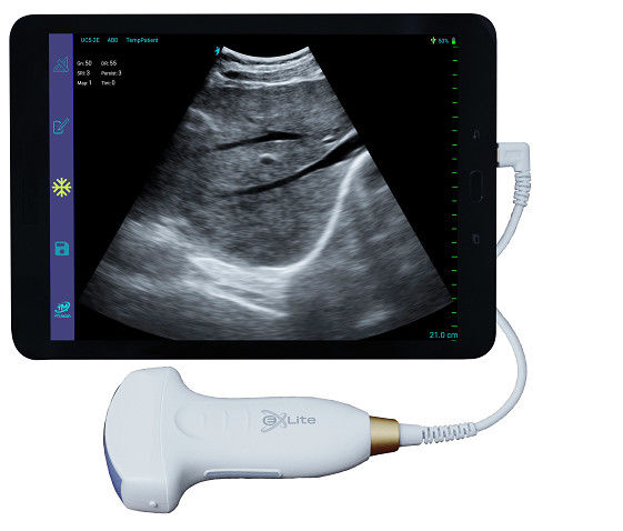 Máy quét siêu âm cầm tay Doppler mảng màu lồi điện tử 3,5 MHz