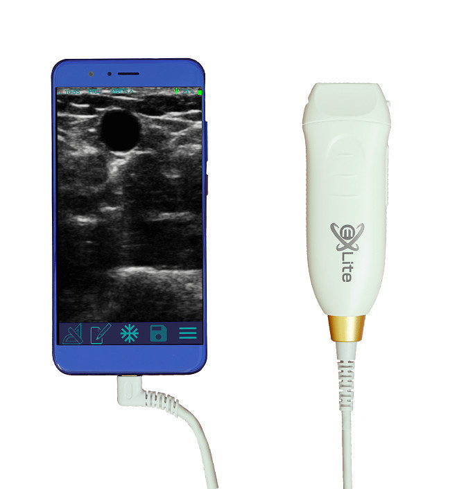 Máy quét siêu âm cầm tay với đầu dò tuyến tính tần số cao 12MHZ để truy cập mạch máu chính xác và thủ tục chèn PICC