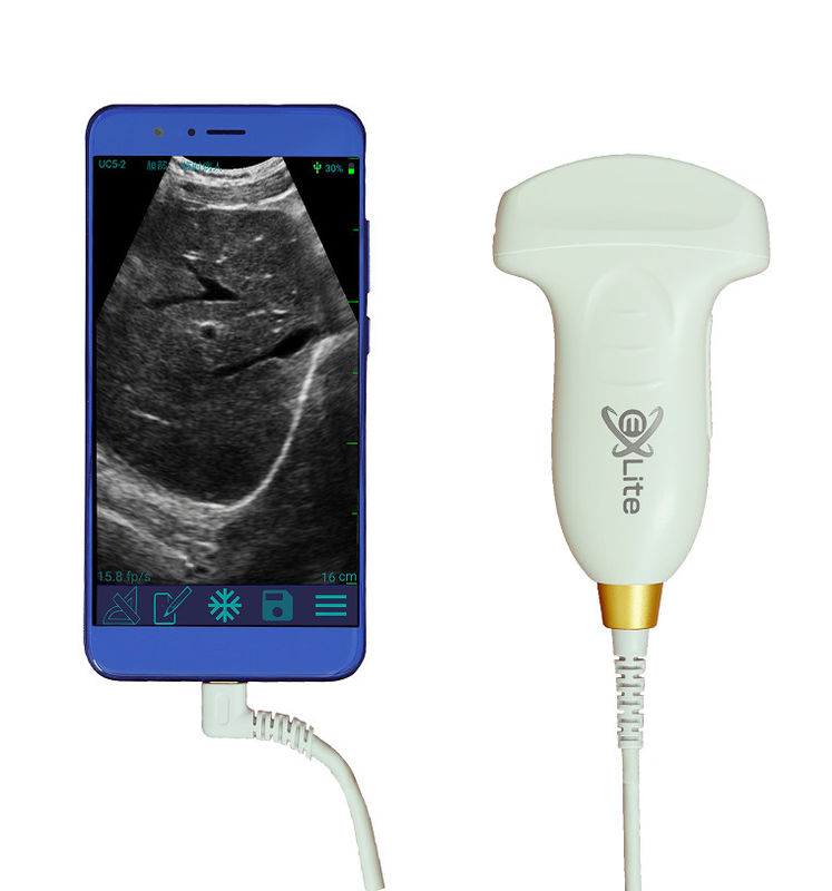 Máy quét siêu âm cầm tay Doppler mảng màu lồi điện tử 3,5 MHz