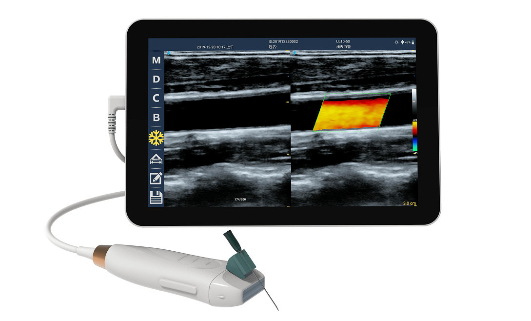 Máy quét siêu âm cầm tay với đầu dò tuyến tính tần số cao 12MHZ để truy cập mạch máu chính xác và thủ tục chèn PICC