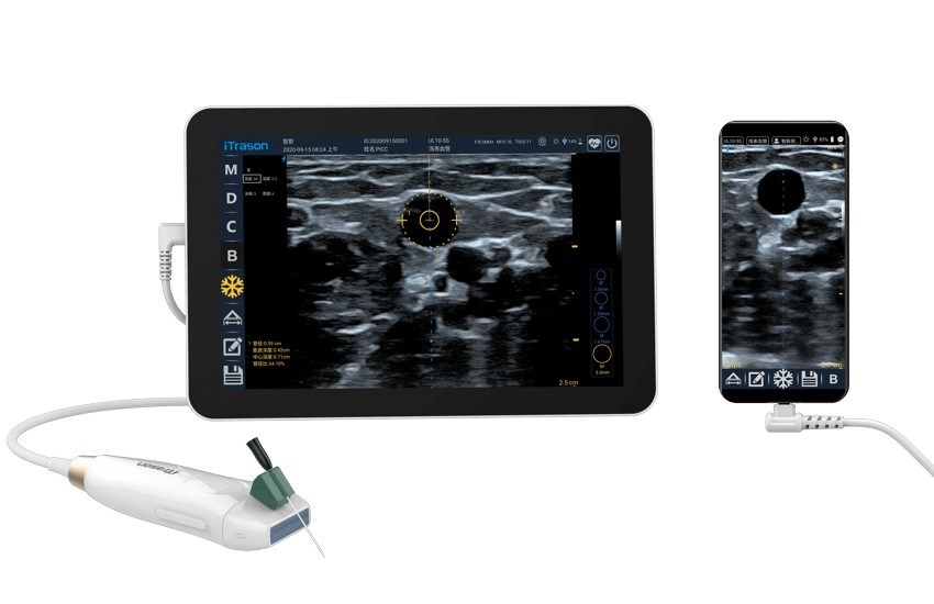 64 Kênh 20mm Depth Handheld Ultrasound Scanner để đánh giá mạch ngoại biên và tiếp cận mạch dẫn đường siêu âm
