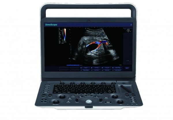 7 Cấp độ hình ảnh Máy siêu âm cầm tay SonoScape E3 với màn hình 15,6 inch