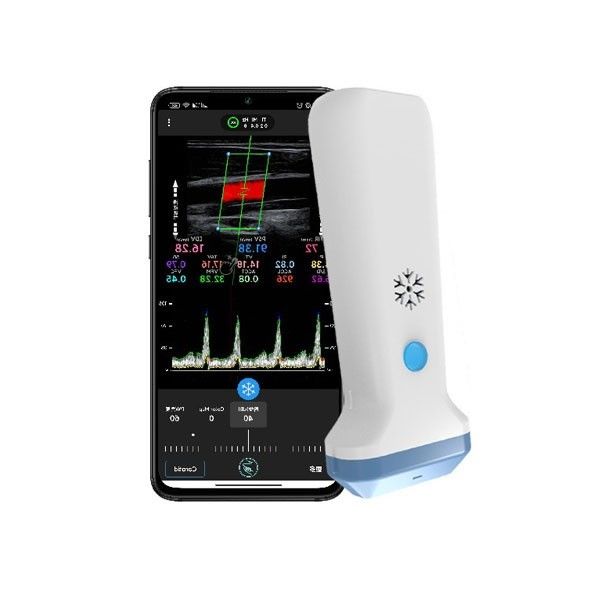 Máy quét siêu âm Doppler màu di động 12,6cm dành cho chuyên gia chăm sóc sức khỏe