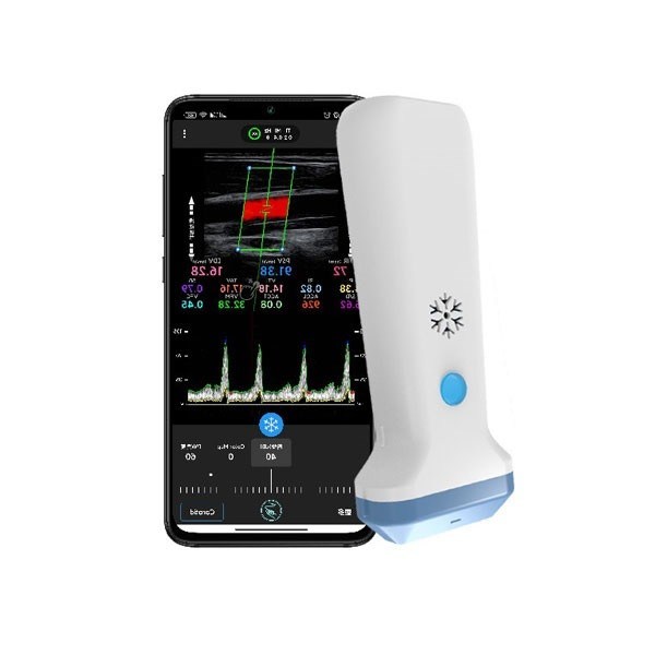 Máy quét siêu âm tuyến tính không dây Doppler màu cầm tay 12,6cm Siêu âm POCUS cầm tay dành cho chuyên gia chăm sóc sức khỏe
