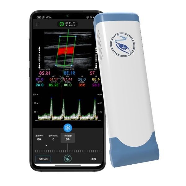 Máy quét siêu âm cầm tay không dây Doppler màu Echo 100 khung hình
