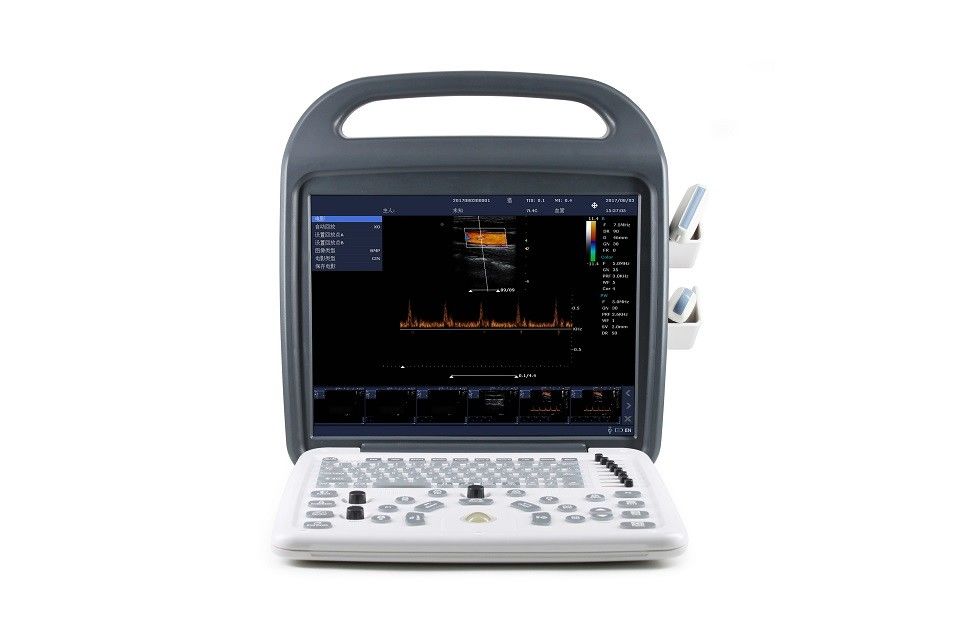 Máy siêu âm Doppler màu màn hình LCD độ nét cao 15'' Di động 7,5kg