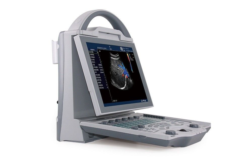 Hệ thống siêu âm Doppler màu máy tính xách tay 2D cấp nhập cảnh 16GB dành cho bà bầu
