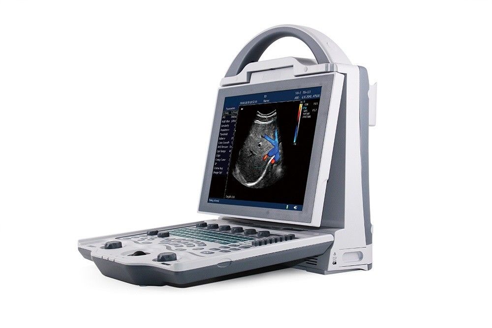 Hệ thống siêu âm Doppler màu máy tính xách tay 2D cấp nhập cảnh 16GB dành cho bà bầu