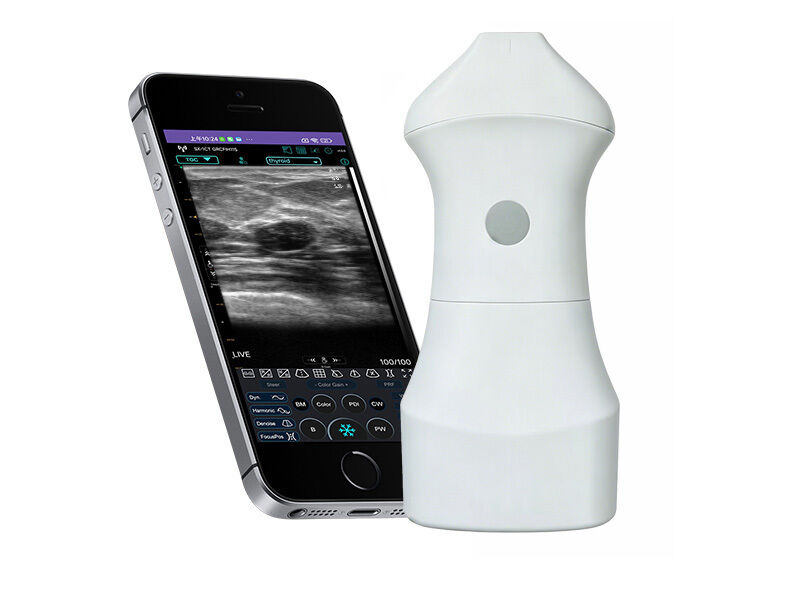Đầu dò siêu âm da tần số cao 24 MHz dành cho y học thẩm mỹ, da liễu và hướng dẫn quy trình tiêm