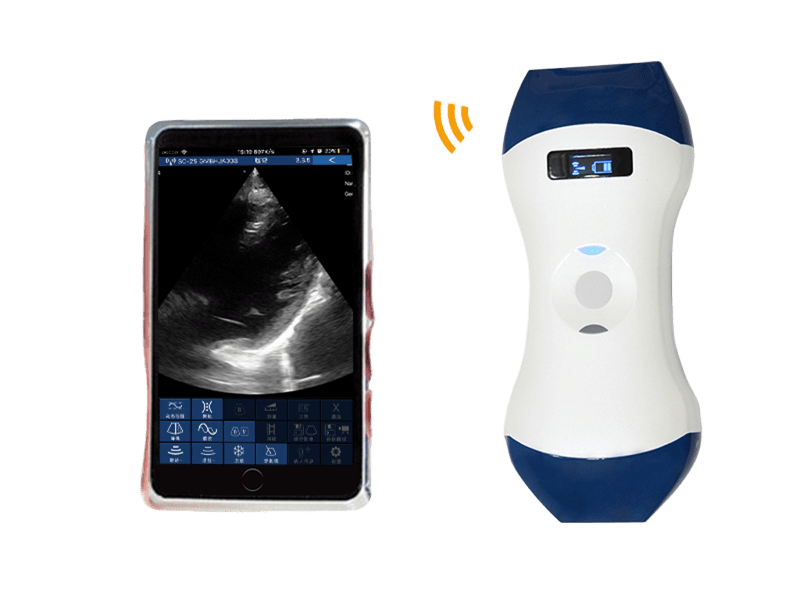 Đầu dò siêu âm cầm tay không dây kích thước lòng bàn tay FDA CE ISO13485 với mảng pha và đầu kép tuyến tính cho POCUS